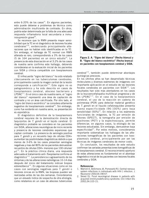 miolo final 1 - Revista Panamericana de Infectología