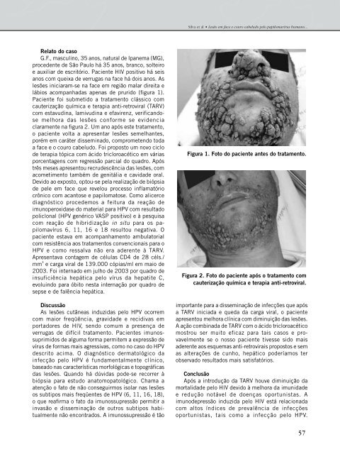 miolo final 1 - Revista Panamericana de Infectología