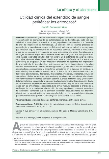 Metaplasia mieloide emedicina hipertensión Metaplasia mieloide emedicina hipertensión