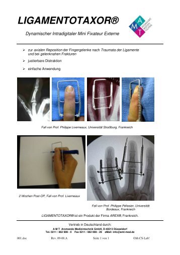 LIGAMENTOTAXOR® - AMT Medizintechnik Düsseldorf