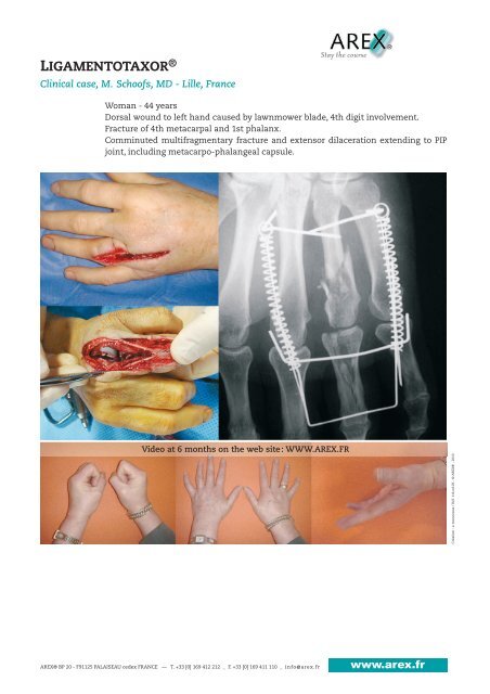 LIGAMENTOTAXOR® - AMT Medizintechnik Düsseldorf