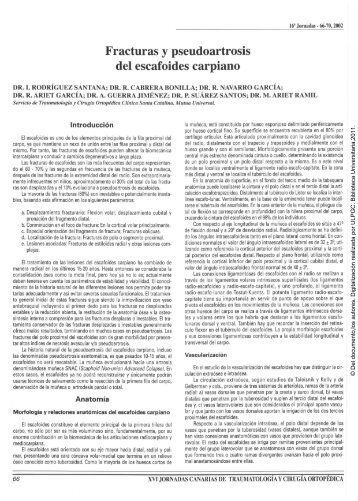 Fracturas y pseudoartrosis del escafoides carpiano - Acceda