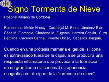 Signo Tormenta de Nieve - Congreso SORDIC