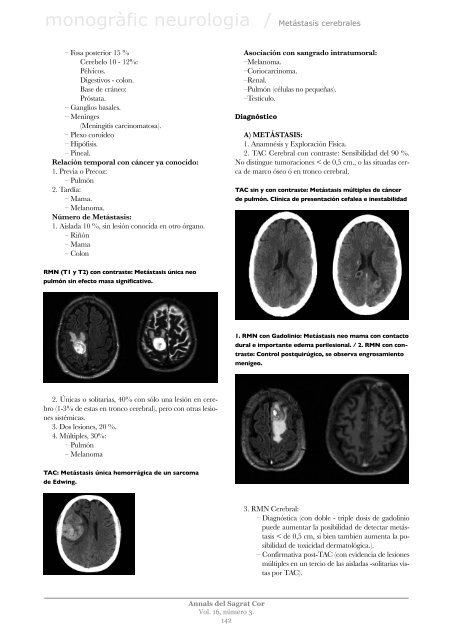 Març 2010 Monográfico Neurología - Hospital Universitari Sagrat Cor