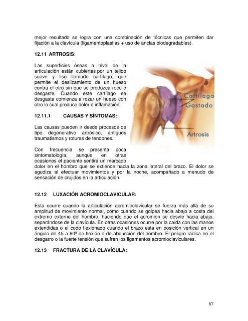 La articulación escapulohumeral en relación con la brazada de libre ...