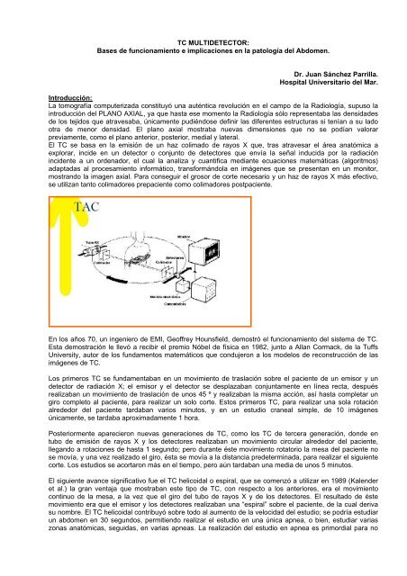 TC MULTIDETECTOR: Bases de funcionamiento e implicaciones en ...