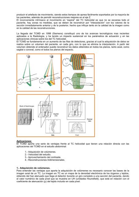 TC MULTIDETECTOR: Bases de funcionamiento e implicaciones en ...