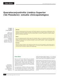Queratoconjuntivitis Límbica Superior (Sd.Theodore ... - Nexus Médica