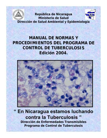 Guía de tratamiento contra la tuberculosis Nicaragua - QuimiNet.com