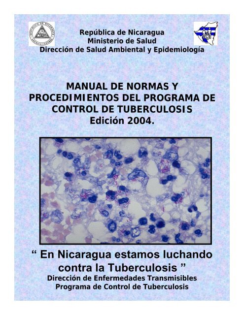 Guia De Tratamiento Contra La Tuberculosis Nicaragua Quiminet Com