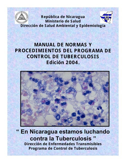 Guia De Tratamiento Contra La Tuberculosis Nicaragua Quiminet Com