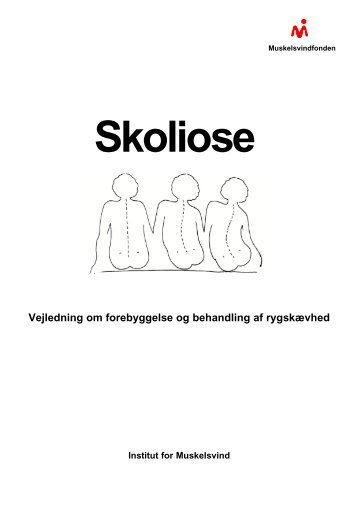 Skoliose - Muskelsvinfonden - Dansk Skoliose Forening