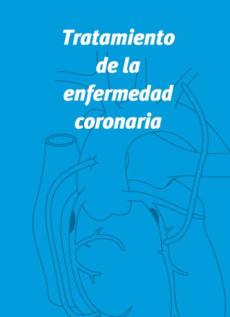 Tratamiento de la enfermedad coronaria