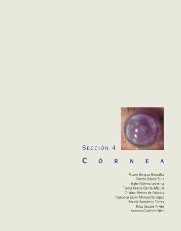 Sección 4. Córnea - sepeap