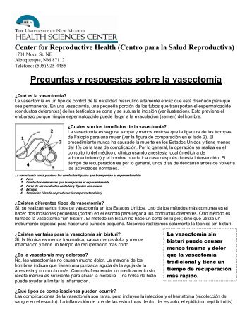 Preguntas y respuestas sobre la vasectomía - HSC