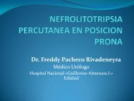 NEFROLITOTRIPSIA PERCUTANEA EN POSICION PRONA