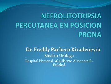 NEFROLITOTRIPSIA PERCUTANEA EN POSICION PRONA