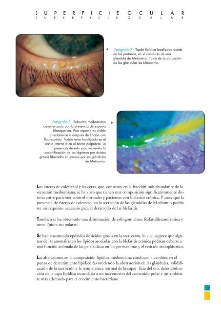 superficie ocular BLEFARITIS - Laboratorios Thea