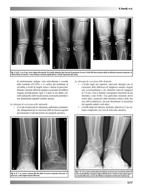 30845 Suppl Giot.pdf - Giornale Italiano di Ortopedia e Traumatologia