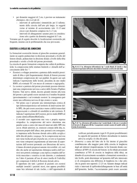 30845 Suppl Giot.pdf - Giornale Italiano di Ortopedia e Traumatologia