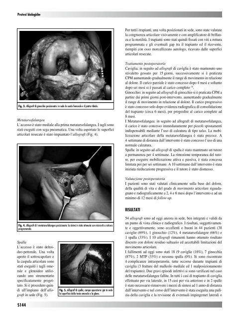 30845 Suppl Giot.pdf - Giornale Italiano di Ortopedia e Traumatologia