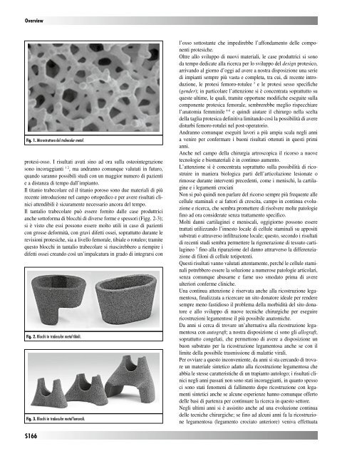 30845 Suppl Giot.pdf - Giornale Italiano di Ortopedia e Traumatologia