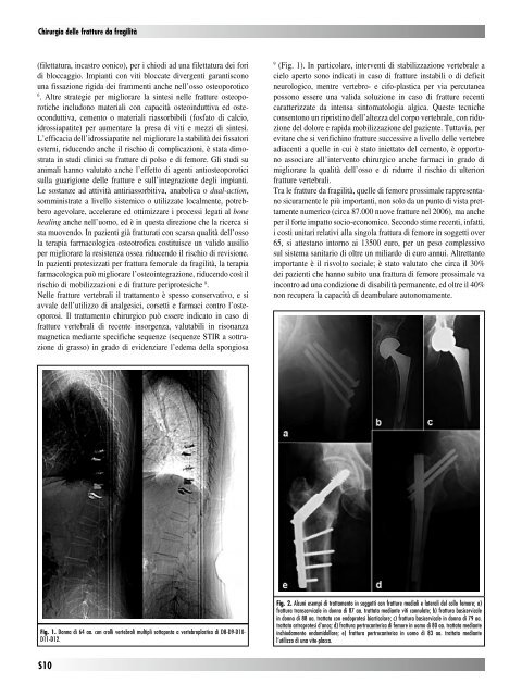 30845 Suppl Giot.pdf - Giornale Italiano di Ortopedia e Traumatologia