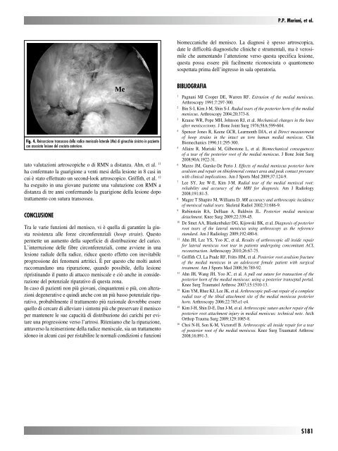 30845 Suppl Giot.pdf - Giornale Italiano di Ortopedia e Traumatologia