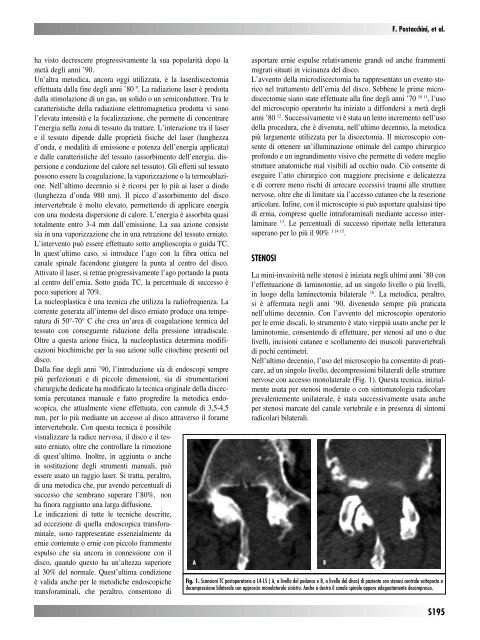 30845 Suppl Giot.pdf - Giornale Italiano di Ortopedia e Traumatologia