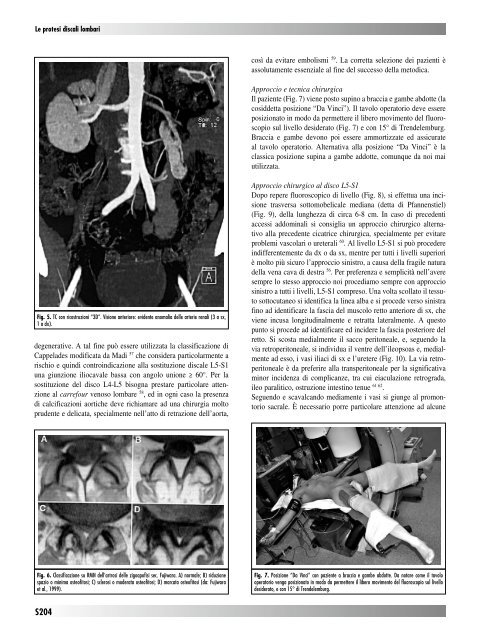 30845 Suppl Giot.pdf - Giornale Italiano di Ortopedia e Traumatologia