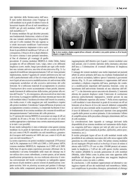 30845 Suppl Giot.pdf - Giornale Italiano di Ortopedia e Traumatologia