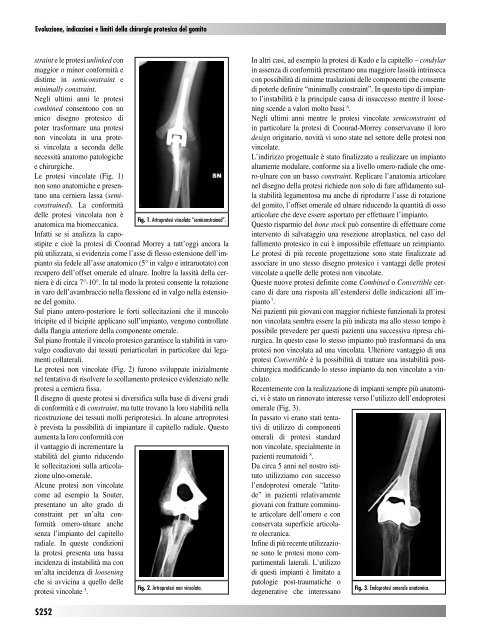 30845 Suppl Giot.pdf - Giornale Italiano di Ortopedia e Traumatologia