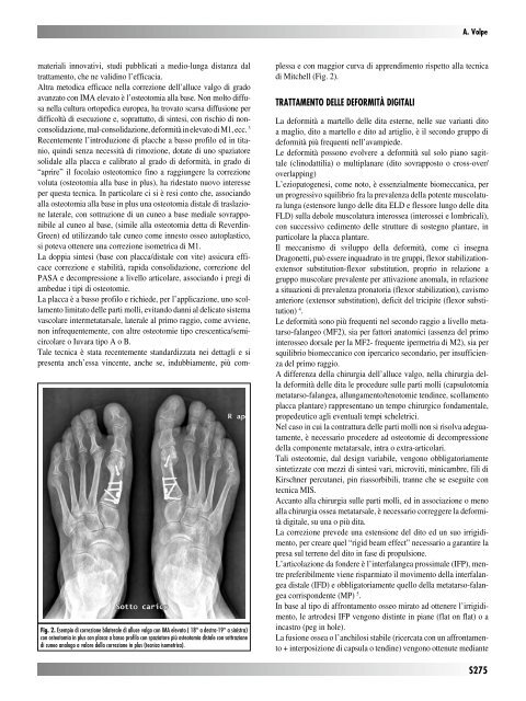 30845 Suppl Giot.pdf - Giornale Italiano di Ortopedia e Traumatologia