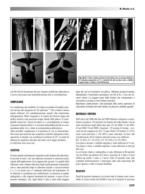 30845 Suppl Giot.pdf - Giornale Italiano di Ortopedia e Traumatologia