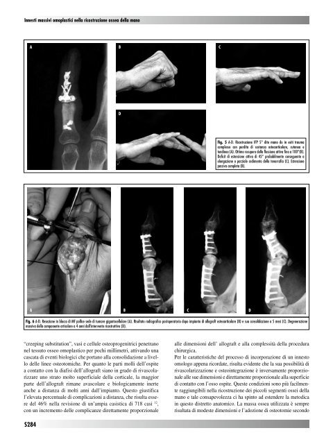 30845 Suppl Giot.pdf - Giornale Italiano di Ortopedia e Traumatologia