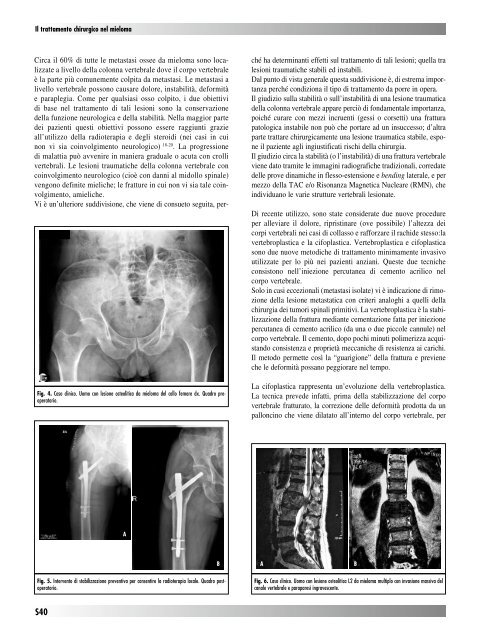 30845 Suppl Giot.pdf - Giornale Italiano di Ortopedia e Traumatologia