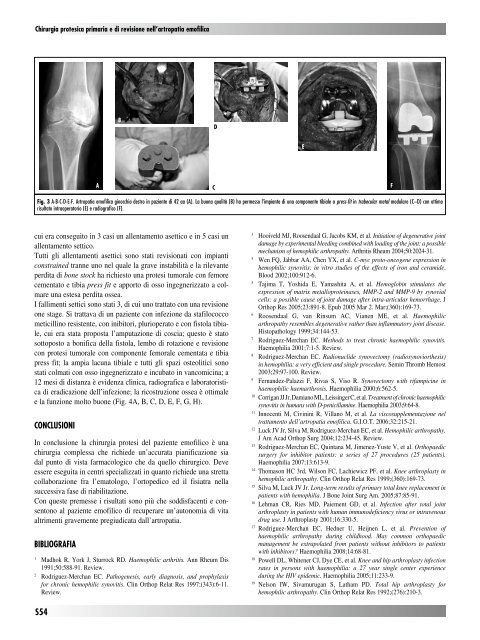 30845 Suppl Giot.pdf - Giornale Italiano di Ortopedia e Traumatologia