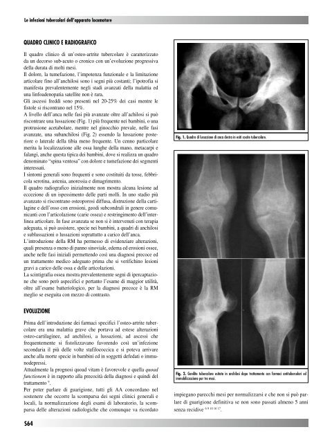 30845 Suppl Giot.pdf - Giornale Italiano di Ortopedia e Traumatologia