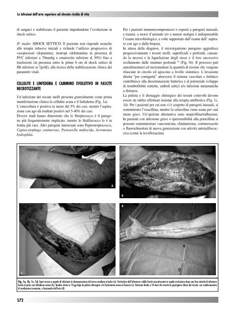 30845 Suppl Giot.pdf - Giornale Italiano di Ortopedia e Traumatologia