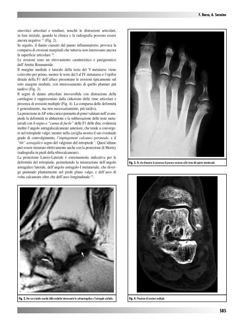 30845 Suppl Giot.pdf - Giornale Italiano di Ortopedia e Traumatologia