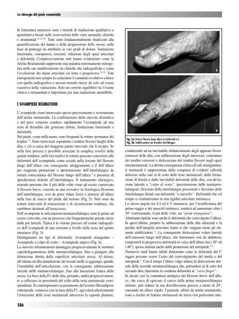 30845 Suppl Giot.pdf - Giornale Italiano di Ortopedia e Traumatologia