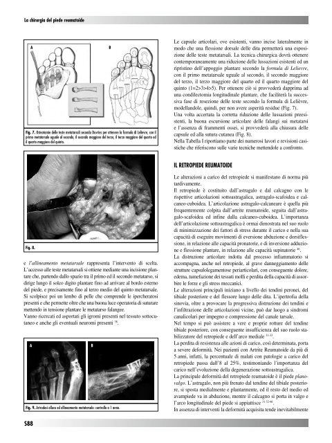 30845 Suppl Giot.pdf - Giornale Italiano di Ortopedia e Traumatologia