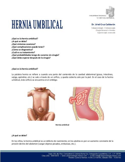 ¿Qué es la hernia umbilical? ¿A qué se debe? ¿Qué síntomas ...