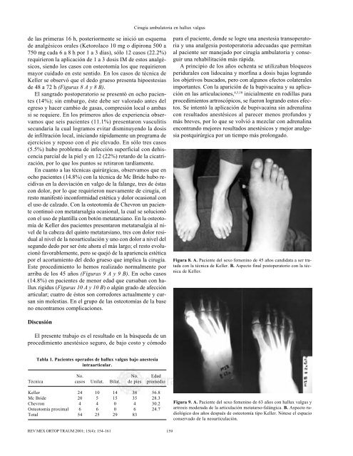 Cirugía ambulatoria bajo anestesia intraarticular ... - edigraphic.com