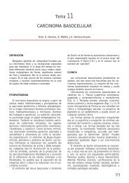 Tema 11 CARCINOMA BASOCELULAR