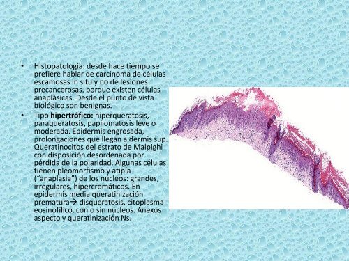 Lesiones precancerosas