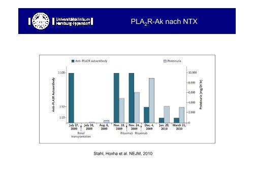 Neues in der Therapie der mem. Glomerulonephritis