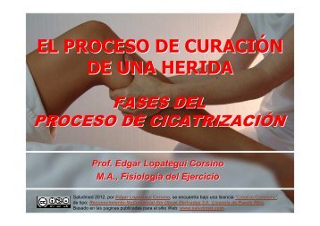 EL PROCESO DE CURACIÓN DE UNA HERIDA - Saludmed