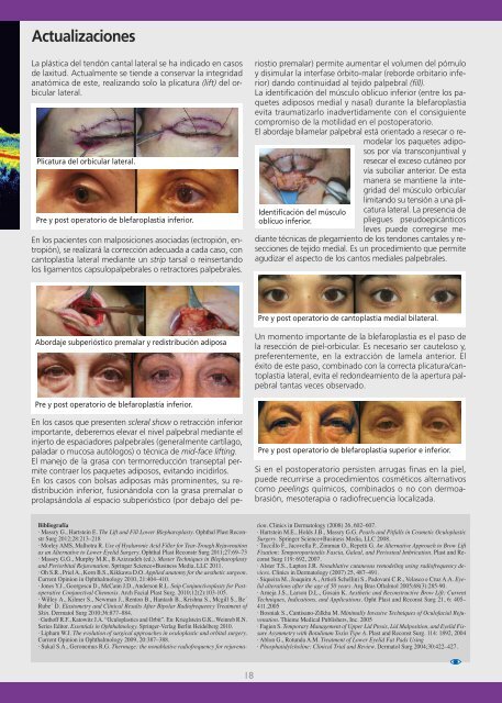SaoNews-19 - Sociedad Argentina de Oftalmología