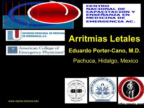 Arritmias Letales